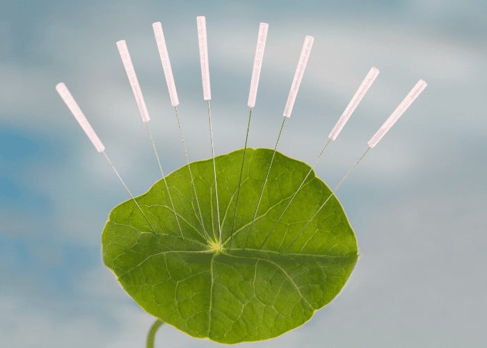 Mountain West Wellness Advanced Acupuncture — Acupuncture